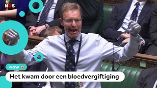 Politicus zonder handen en benen gaat weer naar zijn werk [upl. by Merry]