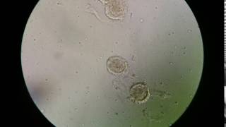 Fertilised decorticated egg of Ascaris lumbricoides [upl. by Cooke]