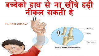 How to fix Pulled elbow  Nursemaids Elbow  HINDI [upl. by Lida438]