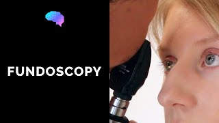 Fundoscopy Ophthalmoscopy  OSCE Guide  UKMLA  CPSA [upl. by Neersan]