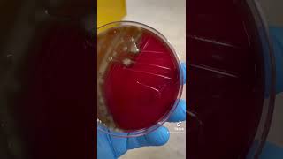 Streptococcus pneumoniae [upl. by Ispep]