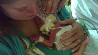 Jacksons sad Preemie cry [upl. by Raviv]