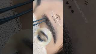 eyebrow transplantation eyebrow eyebrows sopracciglio sobrancrlhas cejas sourcils eyelashes [upl. by Clava]