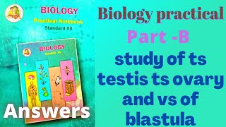 study of ts testis ts ovary and vs of blastula biology practical class 12 answers [upl. by Krauss]