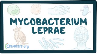 Mycobacterium leprae  an Osmosis Preview [upl. by Anerrol]