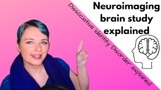 Dissociative identity disorder  Quick overview of neuroimaging brain study by Dr Ellert Nijenhuis [upl. by Redle]