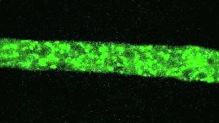 Neurospora organelle structuremov [upl. by Haughay]