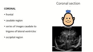 Fontanelle Insights A Comprehensive Anatomy Guide with Clinical Insights [upl. by Sola]