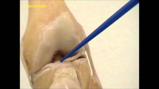 Anatomy of the knee joint [upl. by Trimble]