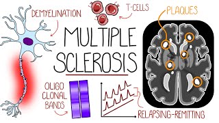 Understanding Multiple Sclerosis Multiple Sclerosis Explained [upl. by Silberman]