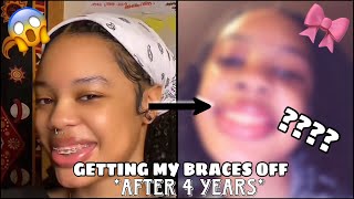 Finally getting my BRACES OFF after 4 LONG years [upl. by Huff]