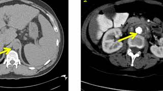 Introduction to Radiology Computed Tomography [upl. by Aneahs809]