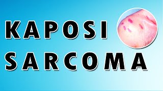 Kaposi Sarcoma Symptoms Treatment and Causes [upl. by Scarrow]