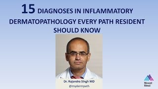 15 Diagnoses in Inflammatory Dermatopathology Every Path Resident Should Know [upl. by Esened]