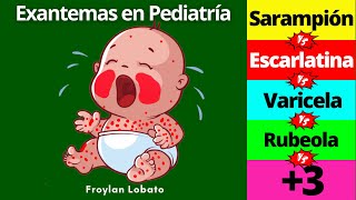 Exantemas en Pediatría ¡Fácil y completo👶 Escarlatina Sarampión Rubeola Varicela Kawasaki etc [upl. by Haelat]