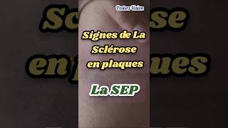 Signes Symptômes Sclérose en plaques SEP scleroseenplaques TroublesDuSommeil neurodegenerative [upl. by Simons]