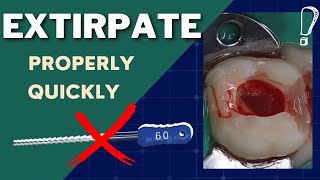 How To PROPERLY and QUICKLY Extirpate Acute Pain  GF016 [upl. by Arron713]