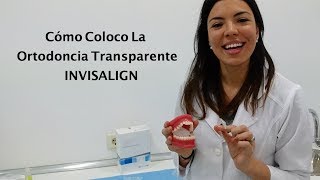 Cómo Se Pone Invisalign  Cómo se coloca  Ortodoncia Invisible  Removible  Sonreir Es Salud [upl. by Lyndell]