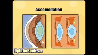 Optometry with Chanaka 11 Refractive Errors Sinhala [upl. by Leunad]