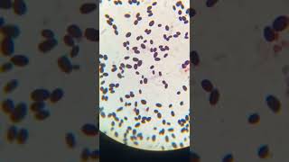 Candida species in urine culture microscope microbiology bmltlecture study music [upl. by Lough828]