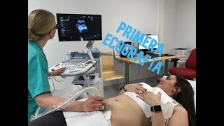 PRIMERA ECOGRAFÍA 🤰🏻 12 SEMANAS DE EMBARAZO [upl. by Zendah82]