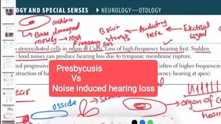 presbycusis Vs noise induced hearing loss otorhinolaryngology 4  First Aid USMLE Step 1 in Urdu [upl. by Gaskins]