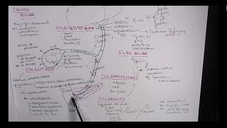 MEJOR EXPLICACIÓN COLELITIASIS COLECISTITIS COLEDOCOLITIASIS COLANGITIS [upl. by Haseena332]