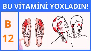 VACİB Halsızlıq yorğunluq varsa B12 vitamini çatışmır [upl. by Kovacs397]