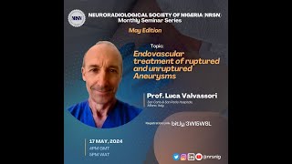 Prof Luca Valvassori Endovascular treatment of ruptured and unruptured Aneurysms  May24 [upl. by Laefar53]