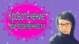 👶Кровотечение при беременности 🔴не всегда выкидыш  Мой опыт [upl. by Neerihs]