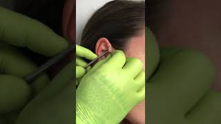 Anti helix piercing [upl. by Crenshaw]