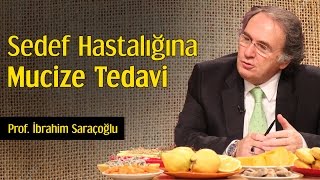 Sedef Hastalığına Mucize Tedavi  Prof İbrahim Saraçoğlu [upl. by Revlis102]