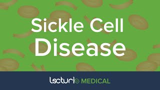 Sickle Cell Hemoglobin SS Disease Acute amp Chronic Presentation  Pediatrics [upl. by Ellevart]