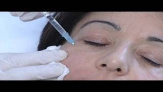 Mesotherapie NCTF Filler Anti ageing Filorgawmv [upl. by Neeloc727]