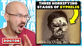 DOCTOR Reacts to The Three Horrifying Stages of Syphilis [upl. by Airda]