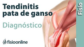 Cómo saber si tengo tendinitis de la pata de ganso [upl. by Athal]