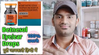 Betnesol N drops use dose benefits and Side effects Full in hindi पुरी जानकारी हिन्दी में [upl. by Eimrots]