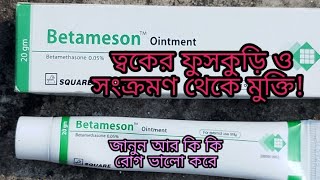 betameson ointment cream  Betameson cream review [upl. by Balch]