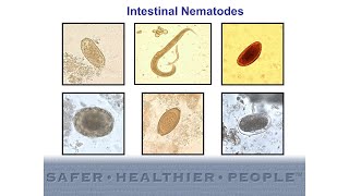 Diagnostic Features of Intestinal Nematodes [upl. by Godiva]