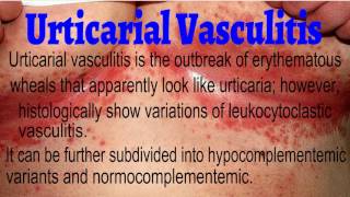 Urticarial Vasculitis  Hypocomplementemic Urticarial Vasculitis [upl. by Lenahs727]