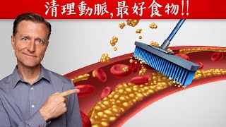 清理動脈最好的食物自然療法柏格醫生 Dr Berg [upl. by Souza]