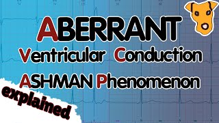 ABERRANT VENTRICULAR CONDUCTION Ashman Phenomenon Explained [upl. by Atse]