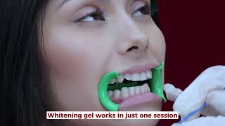 How do we do our teeth whitening [upl. by Almena]