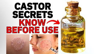 Castor Oil Benefits Risks amp What You Need to Know Before You Try [upl. by Edyaj]