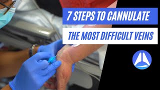 7 steps to cannulate the most difficult veins Live demonstration [upl. by Greenes]