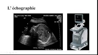 1 Physique de limagerie medicale Introduction Partie II [upl. by Atirehc450]