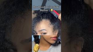 How I fixed my RECEDING hairline curlyhair naturalhair hairstyles [upl. by Aihsena]