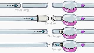 How Does Birth Control Work [upl. by Oberon]