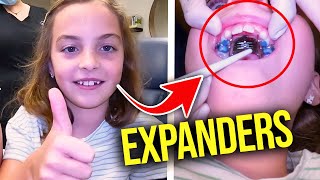 Getting a Palatal ExpanderHow expanders work  McKinney Orthodontist [upl. by Alocin]