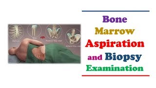 Hematology 🔤 II Bone Marrow Aspiration and Biopsy Examination [upl. by Dobrinsky11]